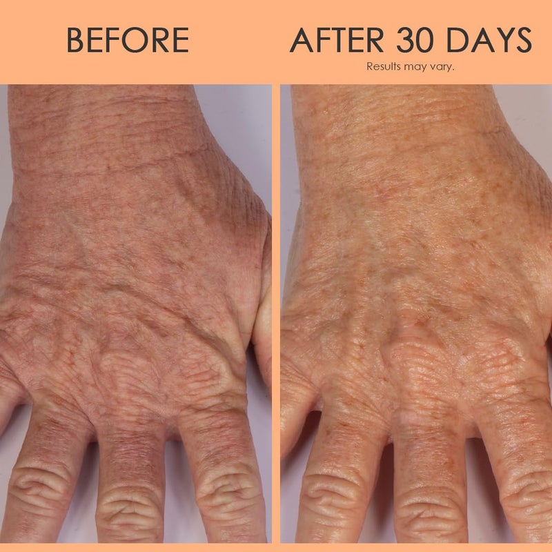 BODY FIRM Crepe Erase Hand Repair Treatment, Anti-Aging Hand Treatment, Lotion with Moisturizing Shea Butter, Vitamin E and Squalane for Cracked, Dry Hands, Supports Wrinkle on Hands, 3 fl oz - Image 5